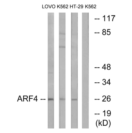 Western Blot - Anti-ARF4 Antibody (C14342) - Antibodies.com