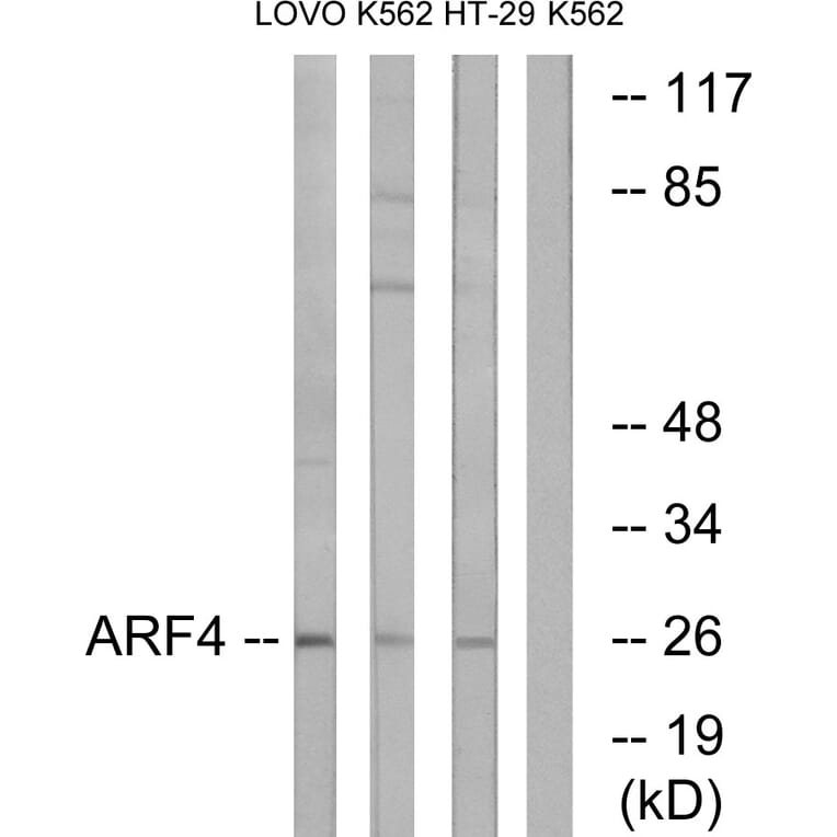 Western Blot - Anti-ARF4 Antibody (C14342) - Antibodies.com