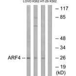 Western Blot - Anti-ARF4 Antibody (C14342) - Antibodies.com