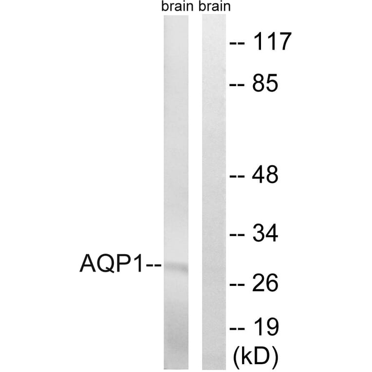 Western Blot - Anti-AQP1 Antibody (C14546) - Antibodies.com