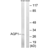 Western Blot - Anti-AQP1 Antibody (C14546) - Antibodies.com