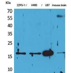 Western blot analysis of 22RV H460, U87, mouse brain cells using Anti-APLN Antibody.