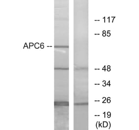 Western Blot - Anti-APC6 Antibody (C12166) - Antibodies.com
