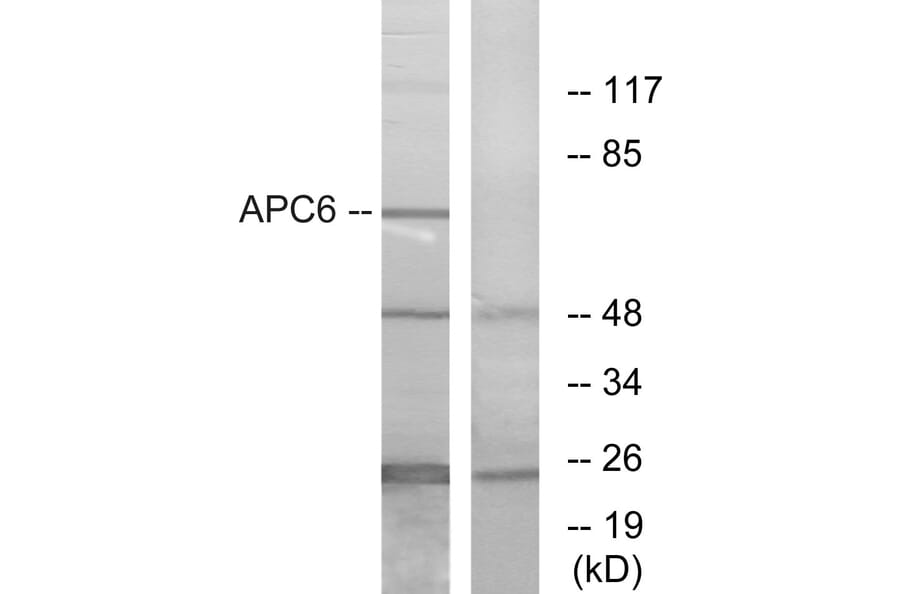 Western Blot - Anti-APC6 Antibody (C12166) - Antibodies.com