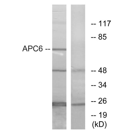 Western Blot - Anti-APC6 Antibody (C12166) - Antibodies.com