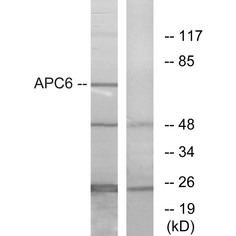 Western Blot - Anti-APC6 Antibody (C12166) - Antibodies.com
