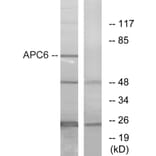 Western Blot - Anti-APC6 Antibody (C12166) - Antibodies.com