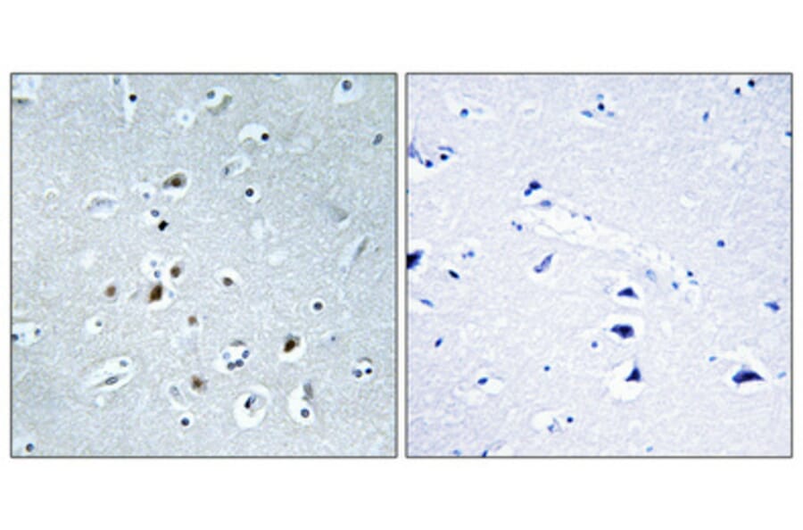 Immunohistochemistry - Anti-AP2C Antibody (C11429) - Antibodies.com