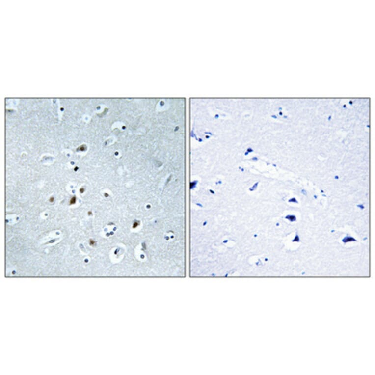 Immunohistochemistry - Anti-AP2C Antibody (C11429) - Antibodies.com
