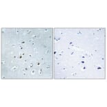 Immunohistochemistry - Anti-AP2C Antibody (C11429) - Antibodies.com