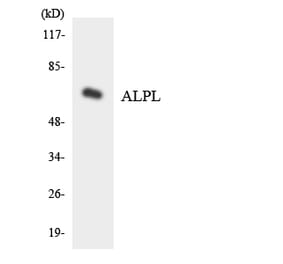 Western Blot - Anti-ALPL Antibody (R12-2479) - Antibodies.com