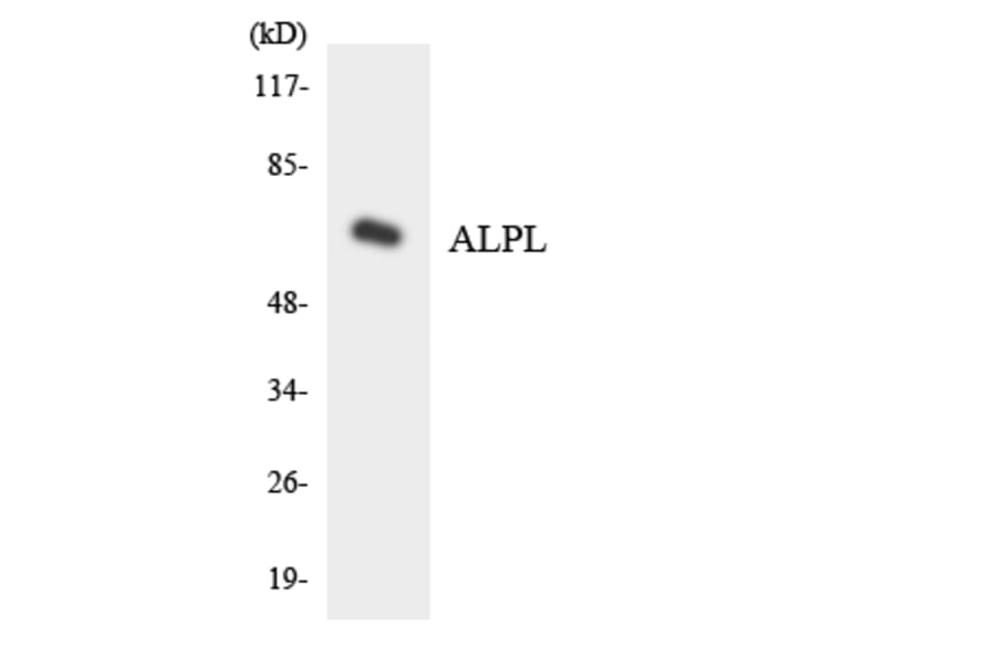 Western Blot - Anti-ALPL Antibody (R12-2479) - Antibodies.com