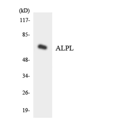 Western Blot - Anti-ALPL Antibody (R12-2479) - Antibodies.com