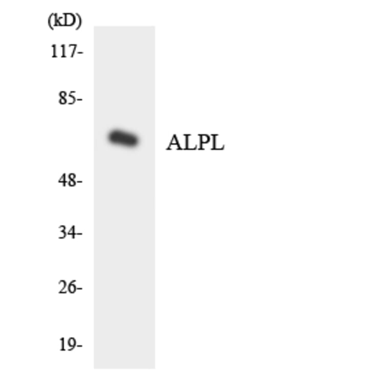 Western Blot - Anti-ALPL Antibody (R12-2479) - Antibodies.com