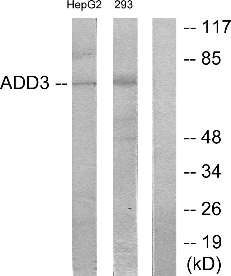 Western blot analysis of lysates from HepG2 and 293 cells using Anti-ADD3 Antibody. The right hand lane represents a negative control, where the antibody is blocked by the immunising peptide.