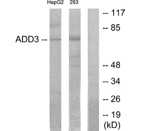 Western Blot - Anti-ADD3 Antibody (C12042) - Antibodies.com