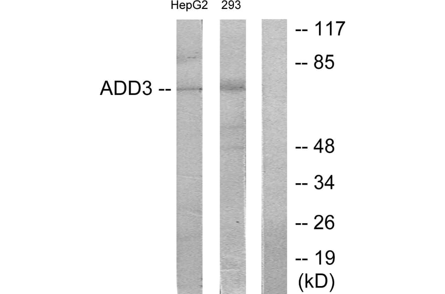 Western Blot - Anti-ADD3 Antibody (C12042) - Antibodies.com