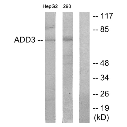 Western Blot - Anti-ADD3 Antibody (C12042) - Antibodies.com