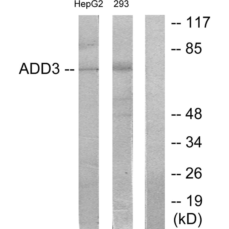 Western Blot - Anti-ADD3 Antibody (C12042) - Antibodies.com