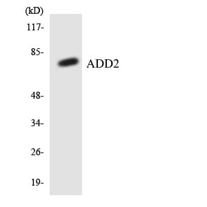 Western blot analysis of the lysates from HeLa cells using Anti-ADD2 Antibody.