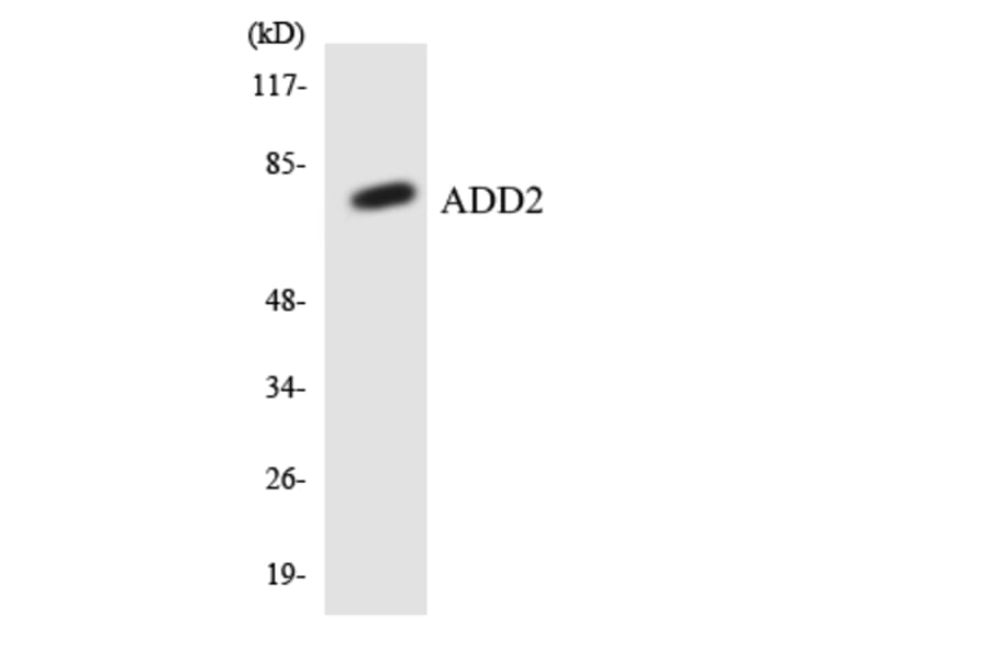 Western Blot - Anti-ADD2 Antibody (R12-2448) - Antibodies.com