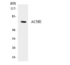 Western Blot - Anti-ACHE Antibody (R12-2435) - Antibodies.com