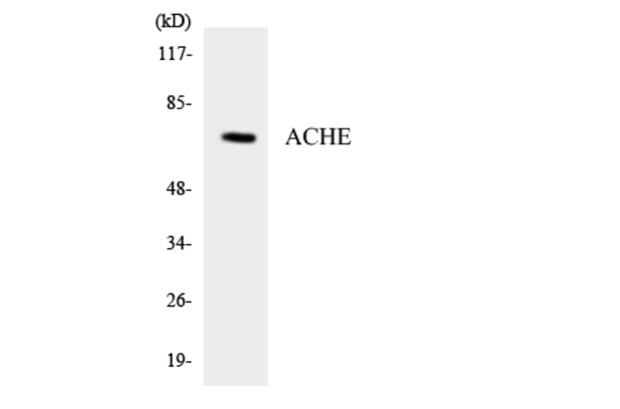 Western Blot - Anti-ACHE Antibody (R12-2435) - Antibodies.com
