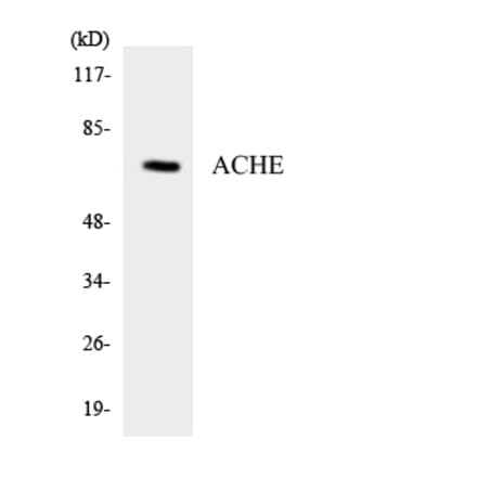 Western Blot - Anti-ACHE Antibody (R12-2435) - Antibodies.com