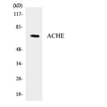 Western Blot - Anti-ACHE Antibody (R12-2435) - Antibodies.com