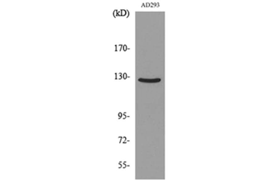 Western Blot - Anti-ABL2 Antibody (C30047) - Antibodies.com