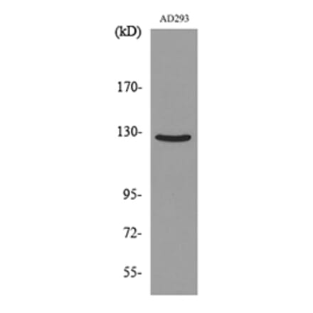 Western Blot - Anti-ABL2 Antibody (C30047) - Antibodies.com