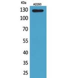 Western Blot - Anti-ABL2 Antibody (C30047) - Antibodies.com