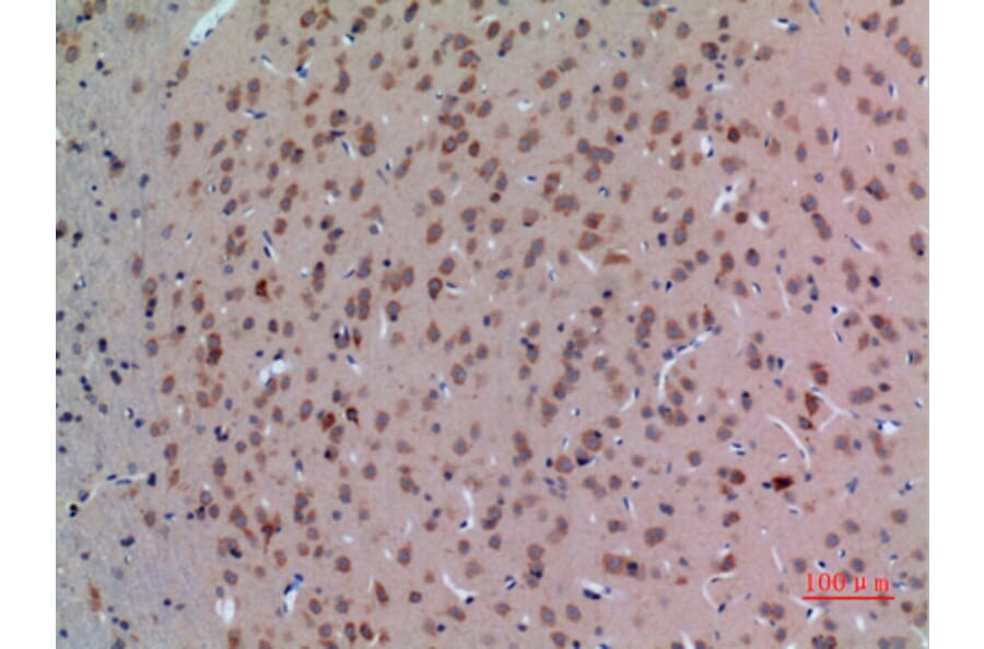 Immunohistochemistry - Anti-ABL2 Antibody (C30047) - Antibodies.com