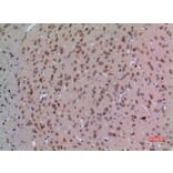 Immunohistochemistry - Anti-ABL2 Antibody (C30047) - Antibodies.com