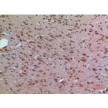 Immunohistochemistry - Anti-ABL2 Antibody (C30047) - Antibodies.com