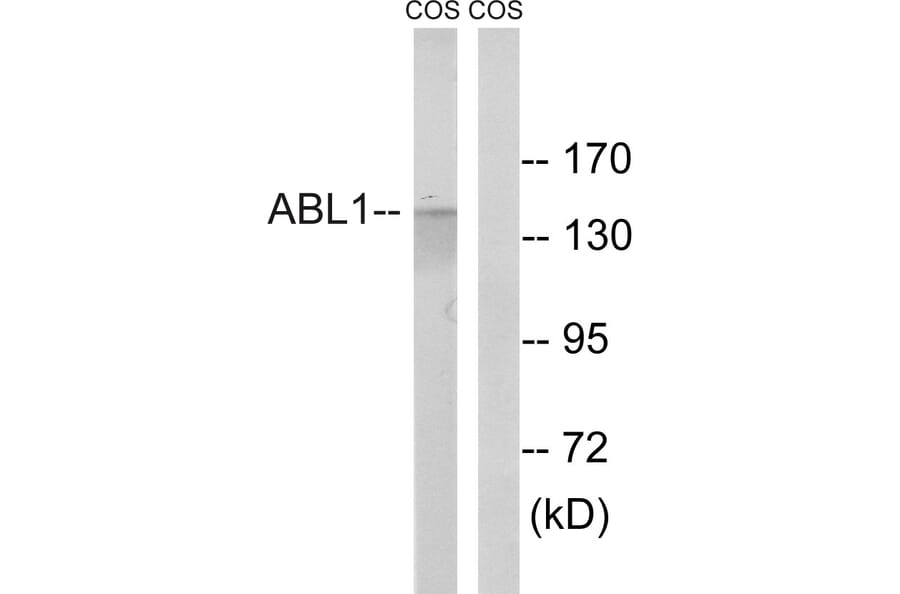 Western Blot - Anti-ABL1 Antibody (B8074) - Antibodies.com