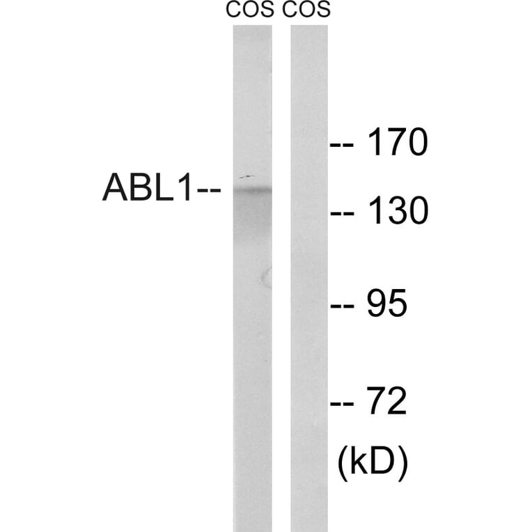 Western Blot - Anti-ABL1 Antibody (B8074) - Antibodies.com