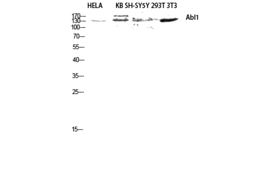 Western Blot - Anti-ABL1 Antibody (B8074) - Antibodies.com