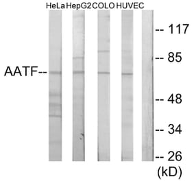 Western Blot - Anti-AATF Antibody (C11778) - Antibodies.com