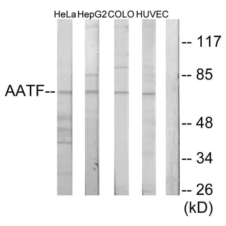 Western Blot - Anti-AATF Antibody (C11778) - Antibodies.com