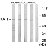 Western Blot - Anti-AATF Antibody (C11778) - Antibodies.com