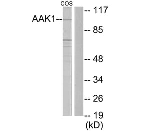 Western Blot - Anti-AAK1 Antibody (C11150) - Antibodies.com