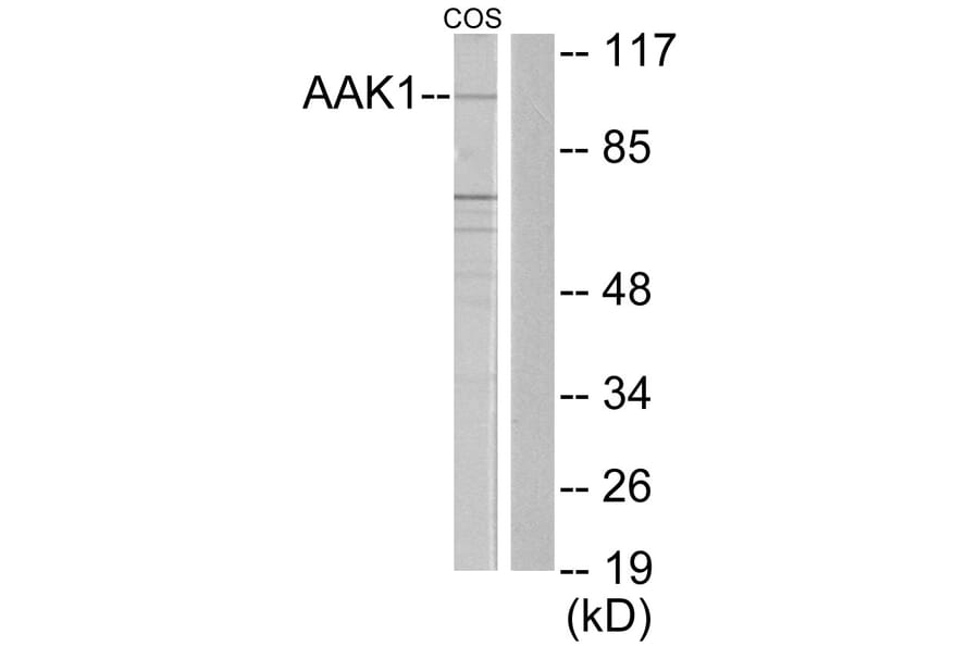 Western Blot - Anti-AAK1 Antibody (C11150) - Antibodies.com