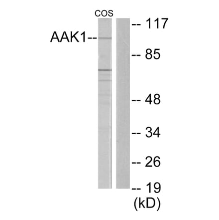 Western Blot - Anti-AAK1 Antibody (C11150) - Antibodies.com