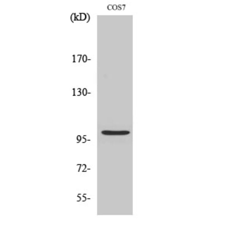 Western Blot - Anti-AAK1 Antibody (C11150) - Antibodies.com