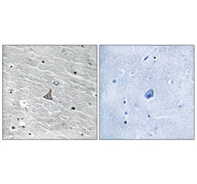 Immunohistochemistry - Anti-VHL Antibody (B8450) - Antibodies.com