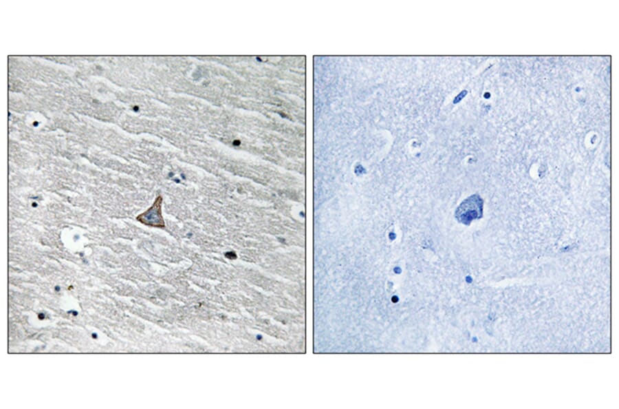 Immunohistochemistry - Anti-VHL Antibody (B8450) - Antibodies.com