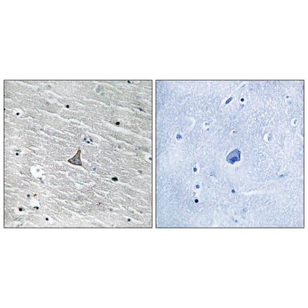 Immunohistochemistry - Anti-VHL Antibody (B8450) - Antibodies.com