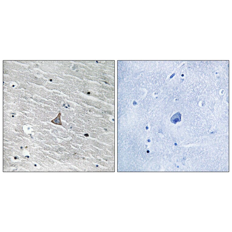 Immunohistochemistry - Anti-VHL Antibody (B8450) - Antibodies.com