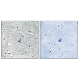 Immunohistochemistry - Anti-VHL Antibody (B8450) - Antibodies.com